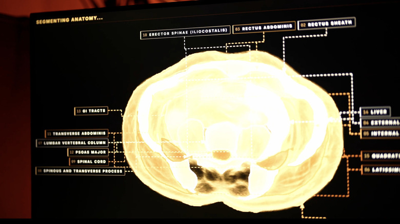 Midjourney's scanner segmenting anatomy from a full-body ultrasonic scan